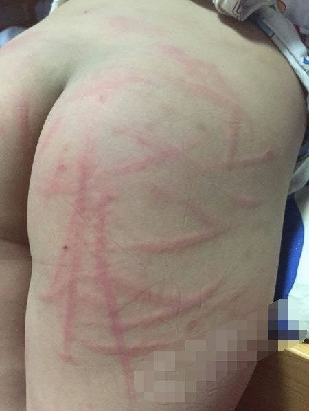 熊孩子28楼抛下15个酒瓶 屁股被爸爸打开花(图