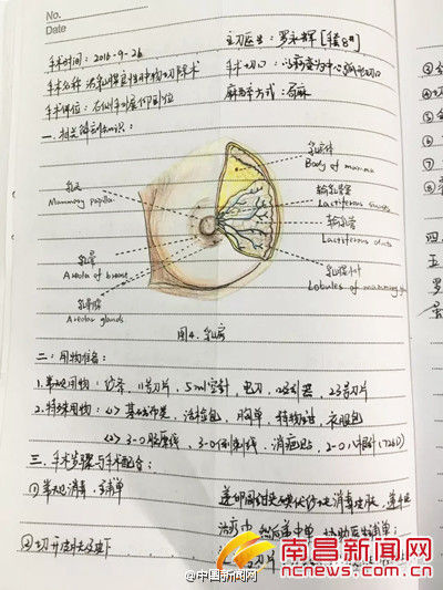 90后美女护士手术笔记走红 字迹工整解剖图手
