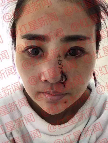 丽江被打毁容女孩近照和遗书首次公开