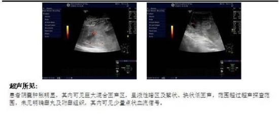 广州17岁男子挥刀自宫 不想做男人要做女人