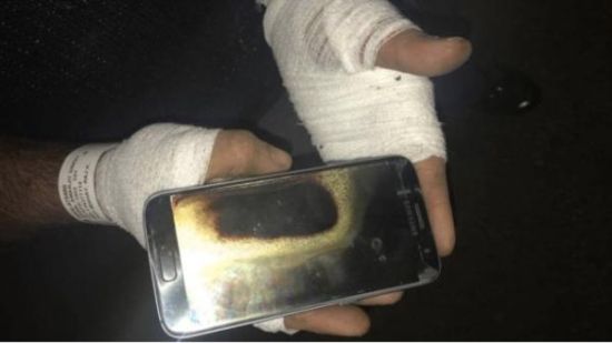 三星s7手机爆炸致使男子手部二级烧伤 随身携带炸弹